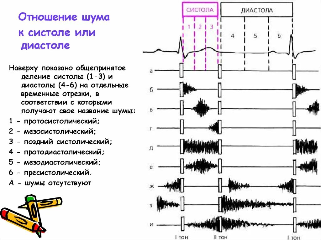 Тоны и шумы сердца. Шумы сердца графически. Временные промежутки в систоле и диастоле. Схема расположения шумов сердца относительно тонов. Сердечные тоны шумы