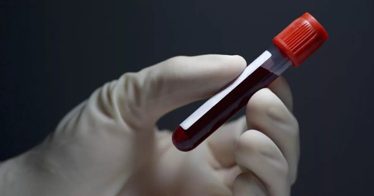 Kan de. Пробирки исследования. Кровь в пробирке. Анализы пробирки. Kan de.