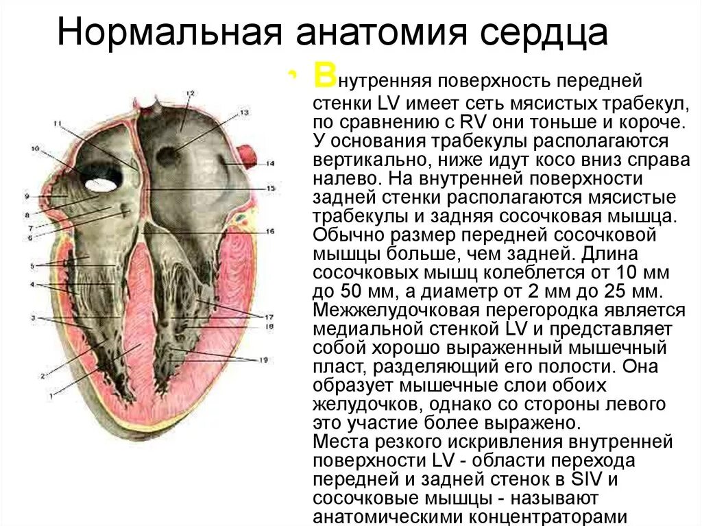 Трабекулы желудочков сердца. Трабекула левого желудочка сердца. Папиллярные мышцы левого желудочка строение. Трабекула левого желудочка сердца. Дополнительная трабекула левого желудочка сердца.