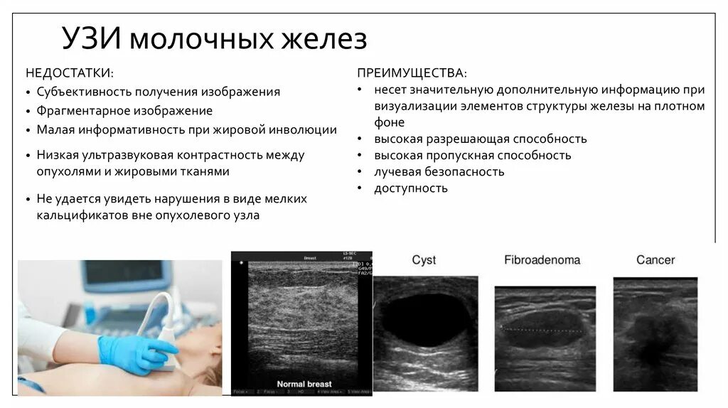 УЗИ молочных желез. Ультразвуковое исследование молочных желез. УЗИ груди.