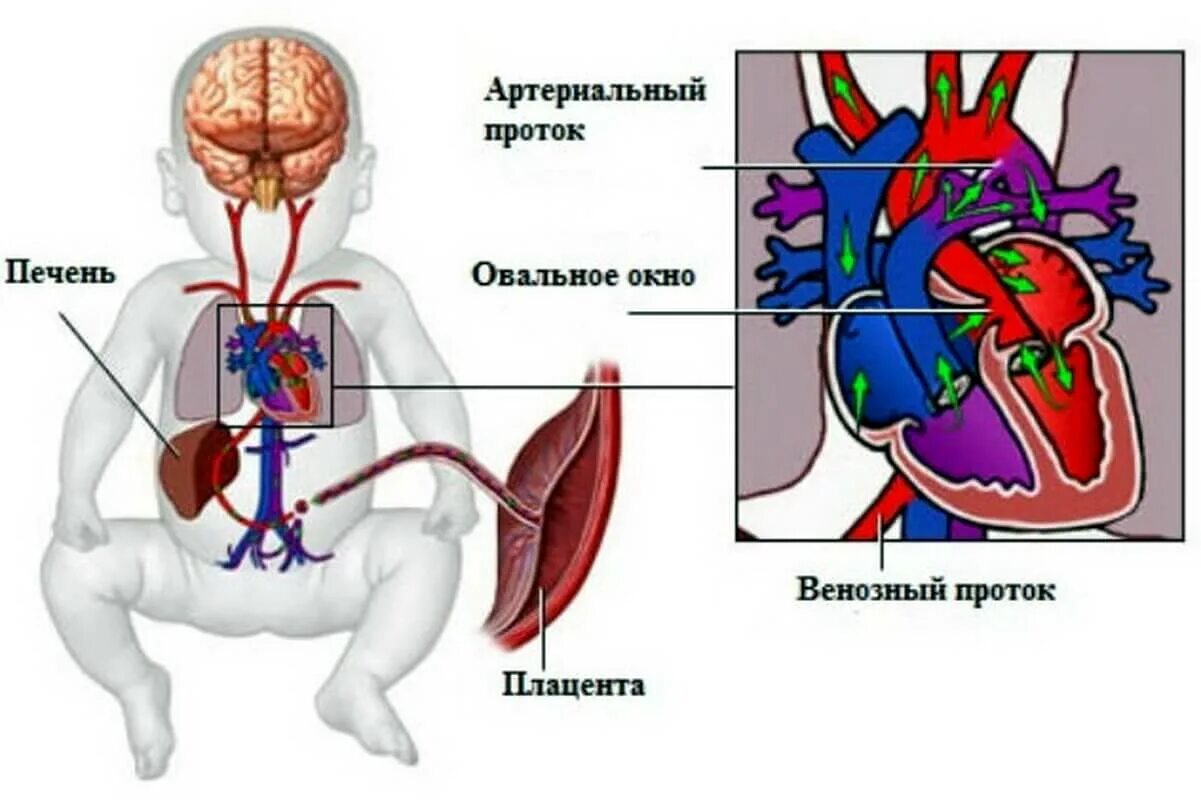 Где находится овальное окно. Овальное окно в сердце у новорожденного открыто на 2 мм. Овальное отверстие в сердце плода. Открытое овальное окно 6 мм у грудничка. Открытое овальное отверстие в сердце у ребенка.