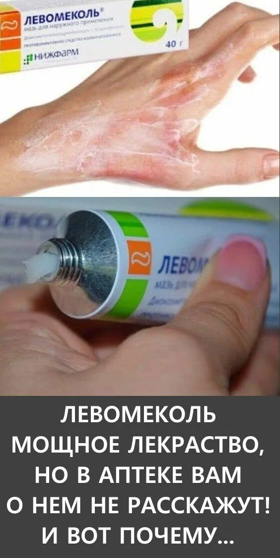 Левомеколь. Левомеколь мазь. Антибактериальные мази левомеколь. Противомикробные мази левомеколь. Левомеколь мазь stada.
