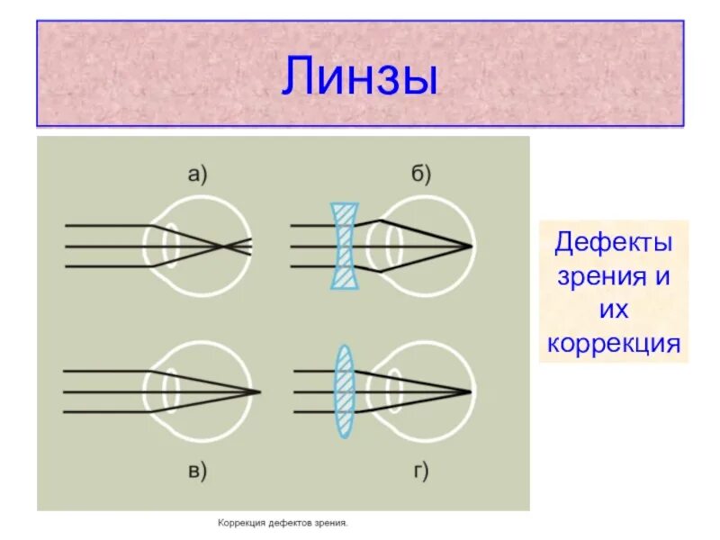 Дефекты зрения ответы. Дефекты зрения. Линзы и дефекты зрения. Дефекты зрения и их исправление. Физика глаз дефекты зрения.