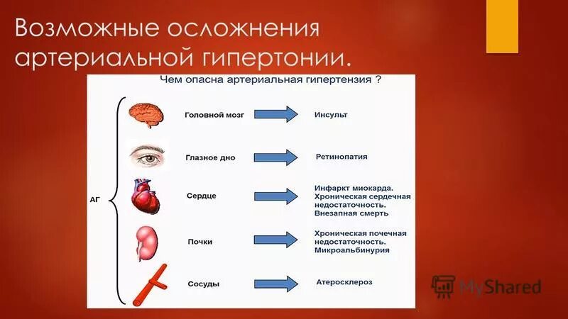 Артериальное давление осложнения. Осложнения симптоматической артериальной гипертензии. Статистика осложнений при гипертонической болезни. Осложнения вторичной артериальной гипертензии. Симптоматические вторичные артериальные гипертензии осложнения.