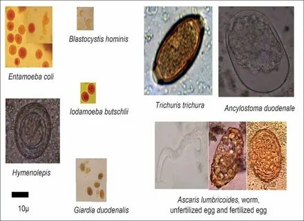 Blastocystis hominis что это