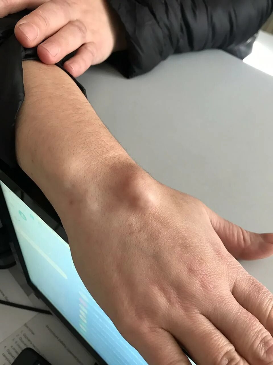 Рука алексея лечит. Ибрагимов нурлан рязань. Ulnar nerve. Ревматологические боли. Рука с салфеткой.