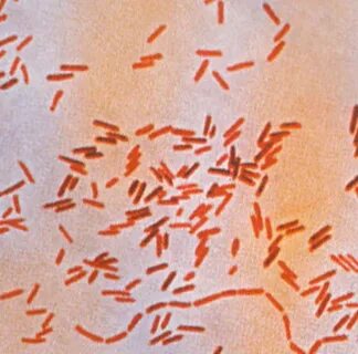 Enterobacteriaceae spp
