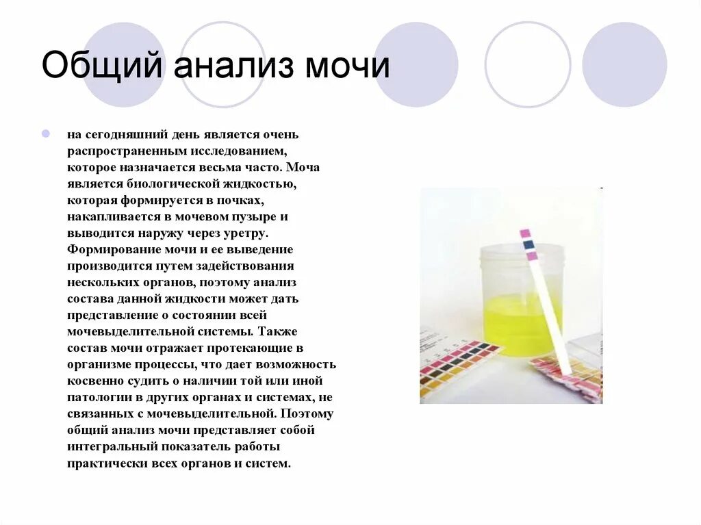 Как нужно сдавать мочу. Общий анализ мочи вывод. Общий анализ мочи заключение. Исследование мочи общий анализ. Общий анализ мочи презентация.