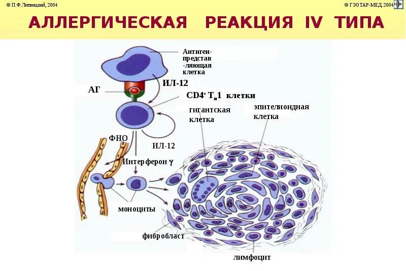 Аллергическая реакция iv типа. Схема гиперчувствительности 4 типа. схема аллергической реакции 4 типа. схема реакции гиперчувствительности 4 типа. типы аллергических реакций 4 типа.