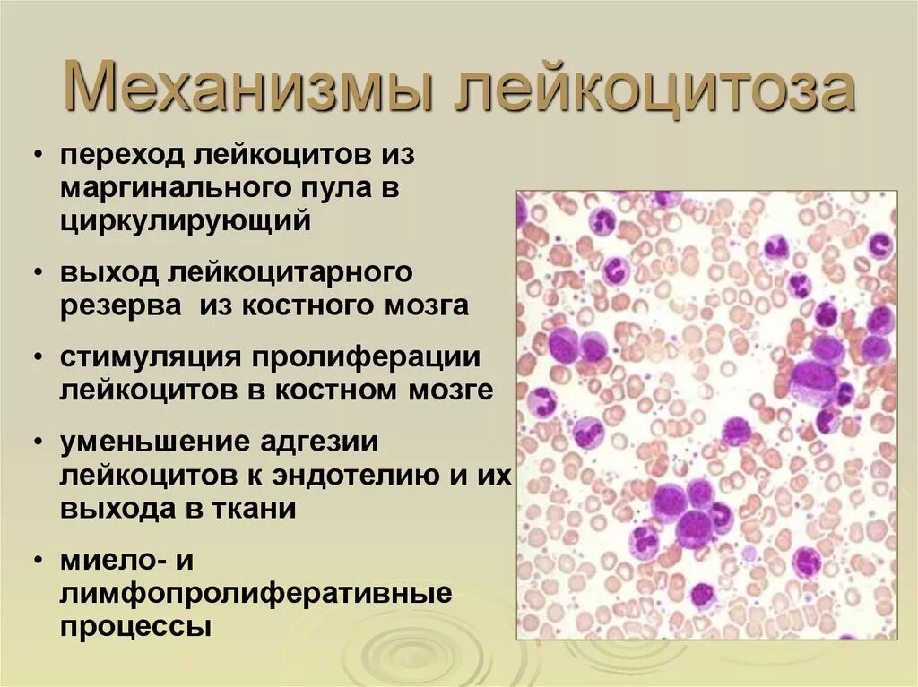 Механизм развития лейкоцитоза. Лейкоцитоз 54. Эозинофильный лейкоцитоз механизм. Эозинофильный лейкоцитоз механизмы развития. Лейкоцитоз и лейкопения