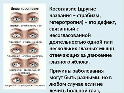 Выбери один глаз
