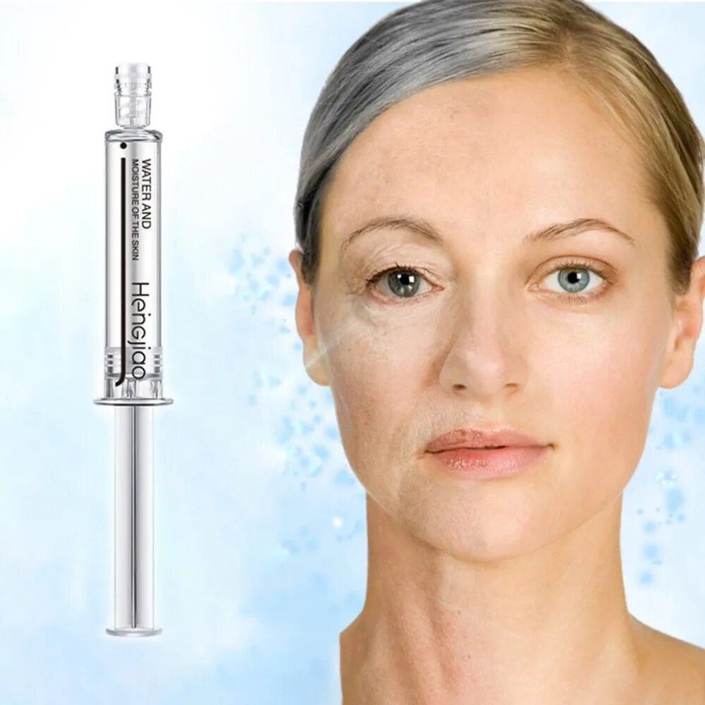 Лицо до и после гиалуроновой кислоты. Отзывы уколов гиалуроновой кислоты. Отзывы уколов гиалуроновой кислоты. Уколы гиалуроновой кислоты до и после. Уколы гиалуроновой кислоты.