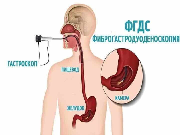 Эфгдс что это такое. Эзофагогастродуоденоскопия (ЭГДС). Прибор для ФГДС желудка.