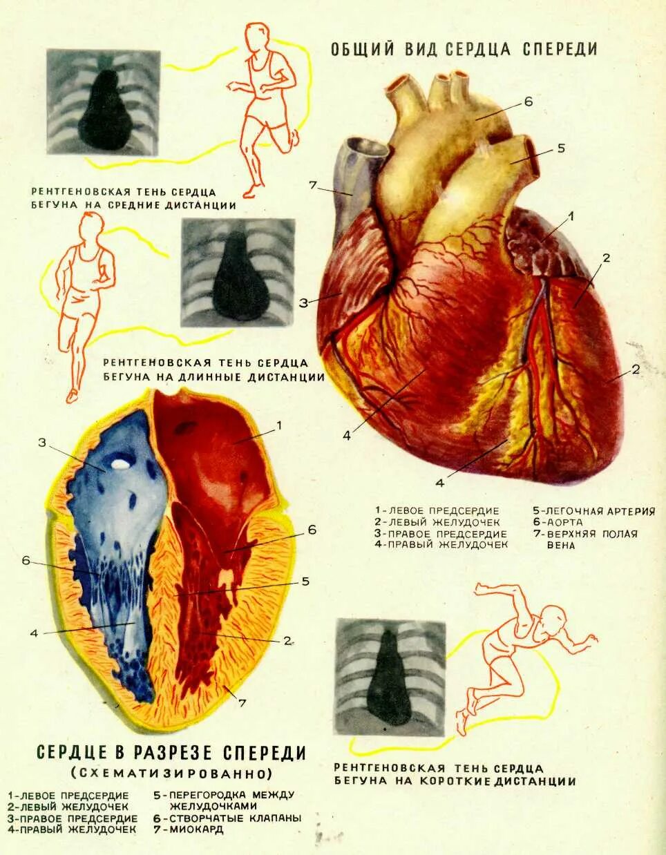 нарушение левый стенки сердца