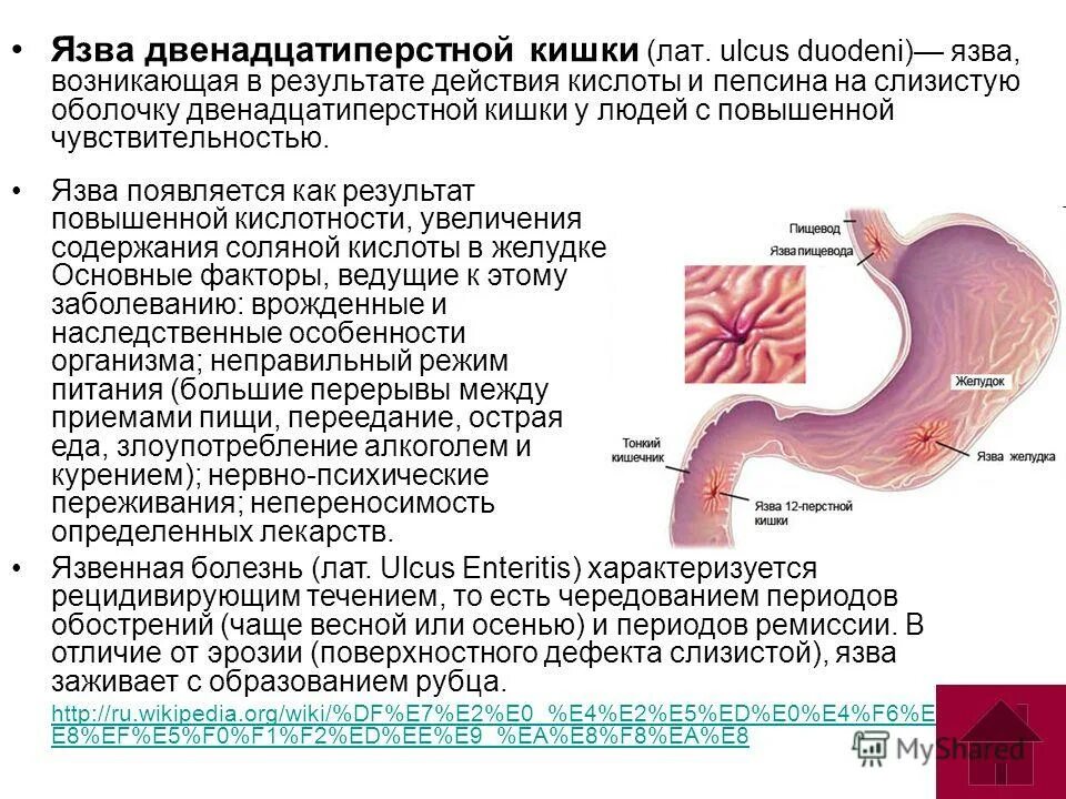 Болезни двенадцатиперстной кишки у ребенка. Язвенная болезнь желудка и 12 перстной. Язвенная болезнь 12 перстной кишки кишки. Синдромы язвенной болезни 12 перстной кишки.