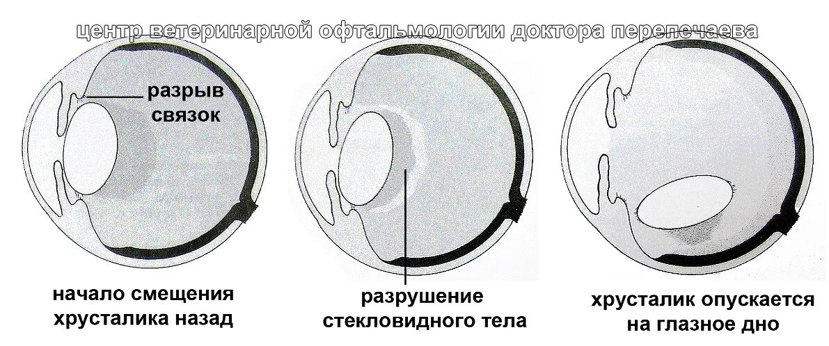Хрусталик кт. Мрт орбит с контрастированием. Мрт орбит и зрительных нервов. Хрусталик кт. Ретробульбарная опухоль орбиты.