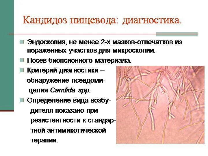 Кандидоз пищевода симптомы. Препараты при кандидозе пищевода. Молочница жкт. Молочница жкт. Молочница жкт.
