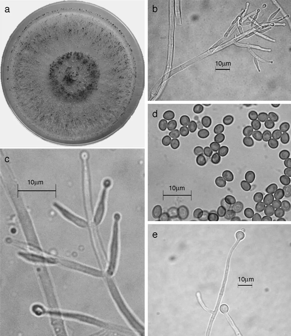 Спороношение это. Trichoderma harzianum спороношение. Триходерма спороношение. Триходерма мицелий. Триходерма строение гриба.