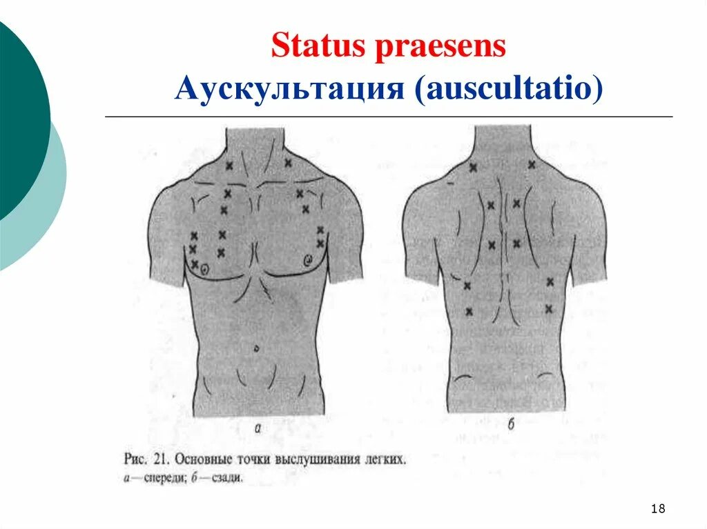 Точка спереди. Аускультация грудной клетки пропедевтика. Аускультация грудной клетки алгоритм. Аускультация легких пропедевтика алгоритм. Схема сравнительной аускультации легких.