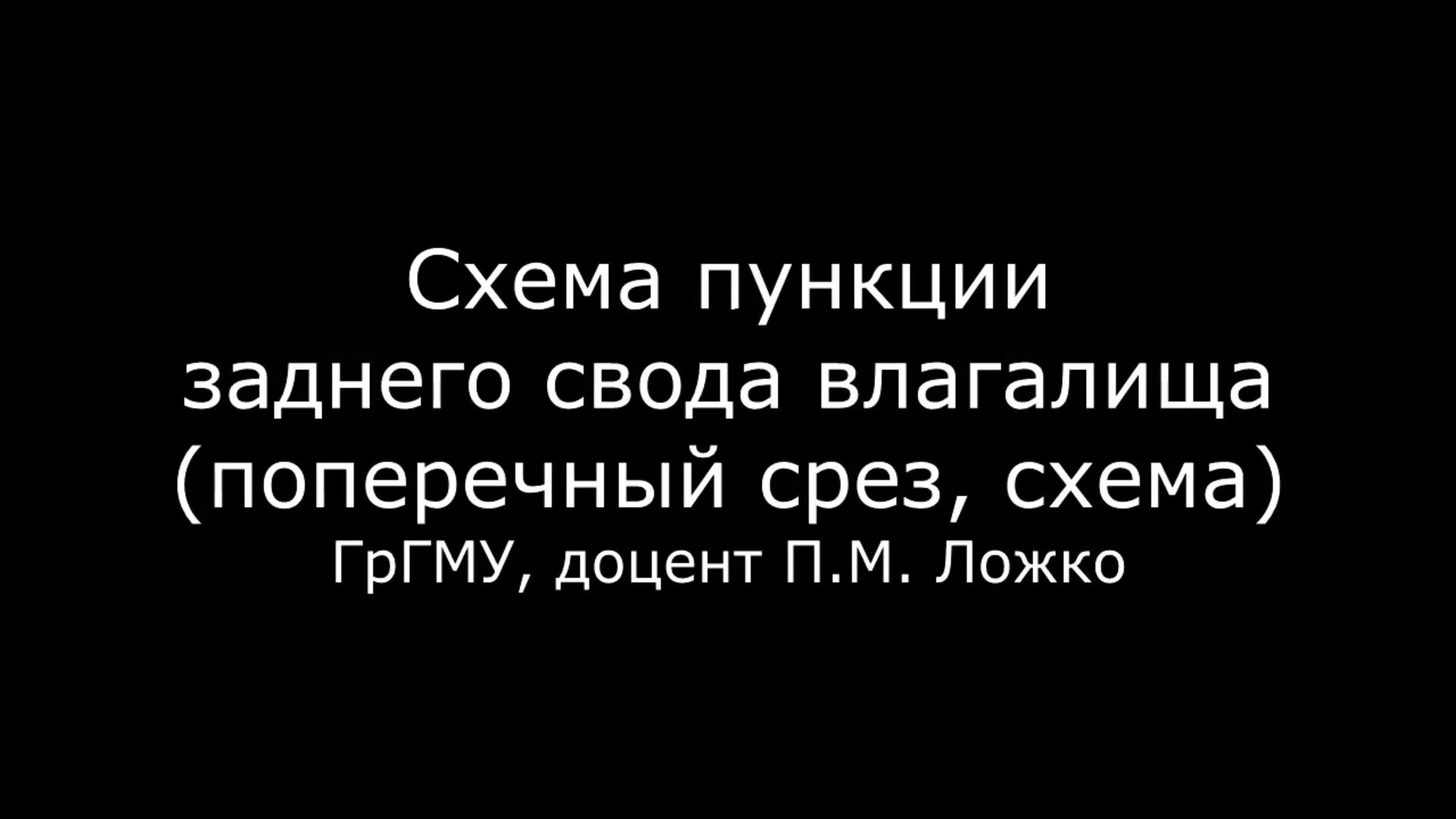 Пункция заднего свода влагалища.