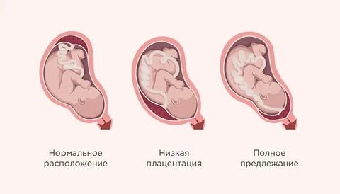 Овуляция прикрепление зародыша к стенке матки