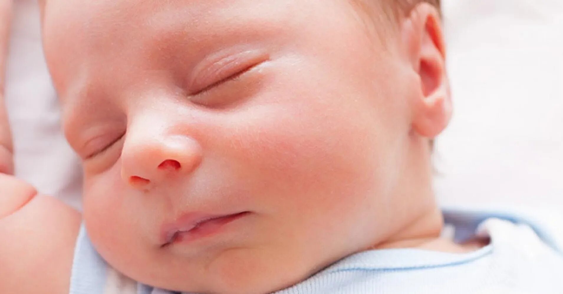 Глаза новорожденного. Опухшие глаза у новорожденного. Подбородок у новорожденных. Отёк века у новорожденных.