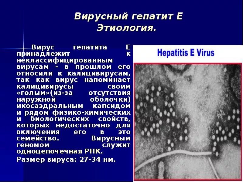 Гепатит hb. Этиология вирусных гепатитов. гепатит с этиология. вирус гепатита а этиология. вирусный гепатит е клиническая картина.