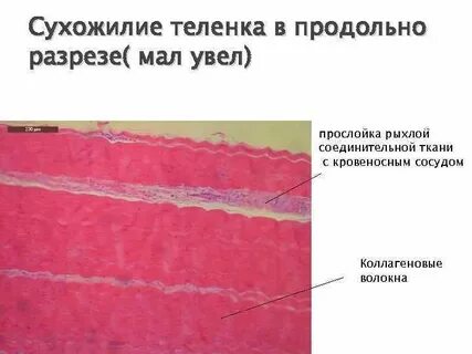 Сухожилие ткань