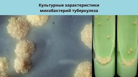 Микобактерии туберкулеза питательные среды