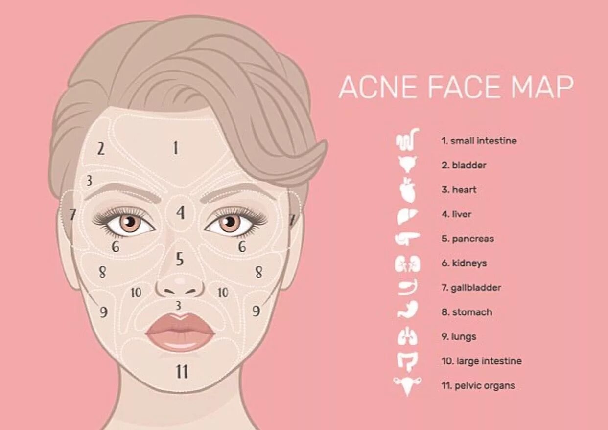 Acne Map and Your Health Pimples on face, Face mapping acne, Face mapping