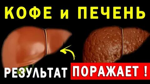 Кофе для печени