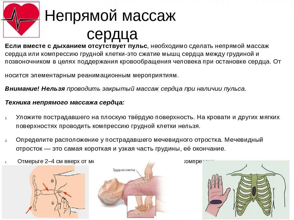 Частота закрытого массажа сердца. Наружный непрямой массаж сердца. Кратко. Правила проведения непрямого массажа сердца кратко. Опишите технику непрямого массажа сердца. Непрямой массаж сердца алгоритм кратко.