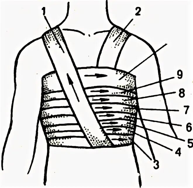 Техника наложения повязок на грудную клетку