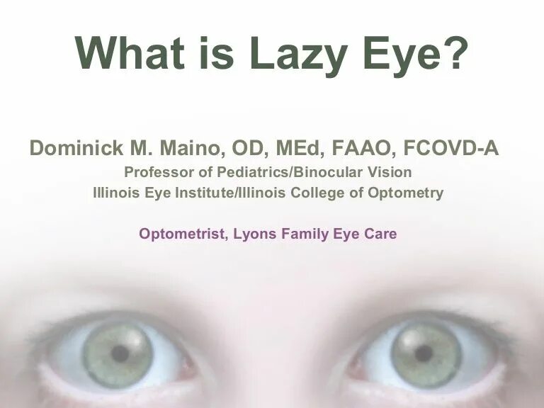 Lazy eye. Lazy eye means. lazy eye - soulship. lazy eye view.