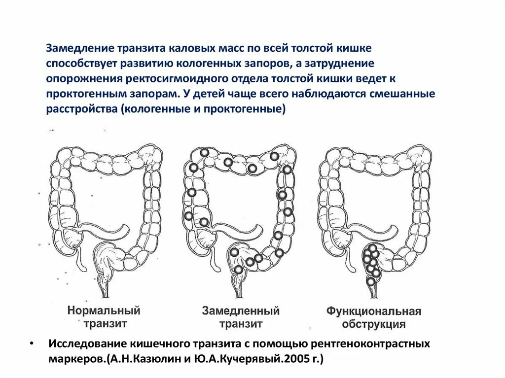 Толстая кишка запор. Формирование каловых масс. Функциональные расстройства Толстого кишечника. Формирование каловых масс происходит в. Процесс формирования каловых масс.