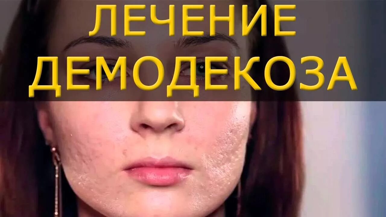 Села ни лицо