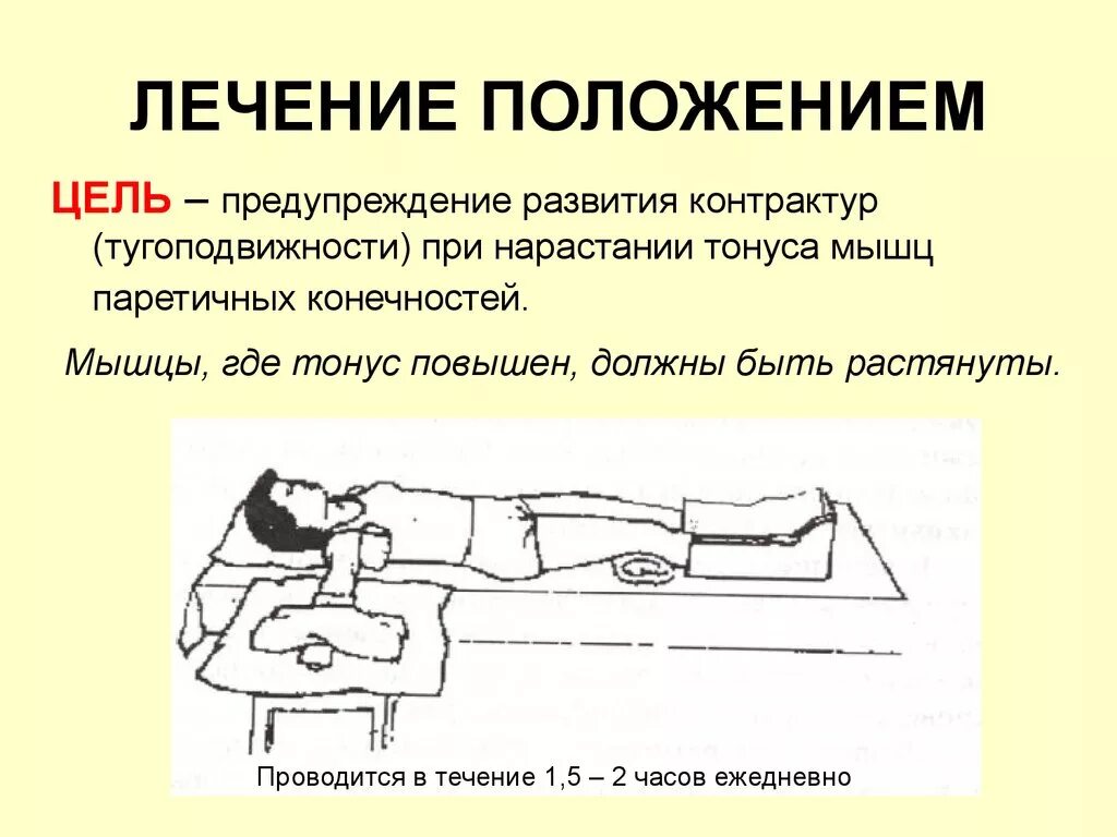 Контрактура лфк