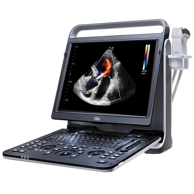 Chison st 30. Chison sonotouch 60. Chison sonotouch. Chison sonotouch. Chison sonotouch.
