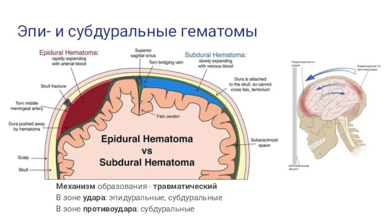 Как отличить гематому