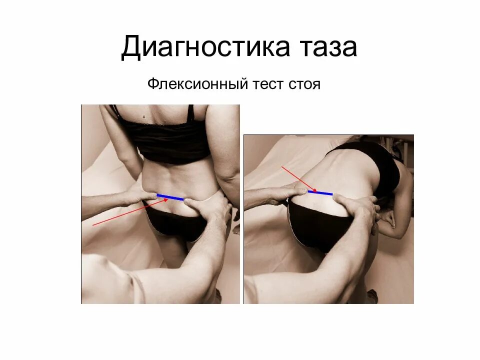 Таз тест. Большой и малый таз анатомия разделения. Перелом симфиза лонного сочленения. Копчик и тазобедренная кость. Тазовая кость иконка.