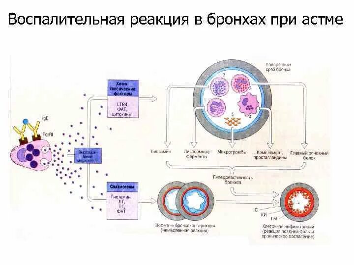 Клетки воспалительной реакции. Клетки воспалительной реакции