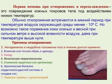 Повреждения вызванные действием высоких температур
