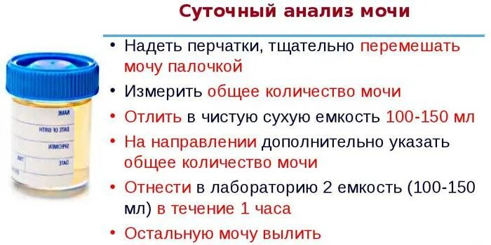 Суточная моча на белок как собирать. Емкость для сдачи суточного анализа мочи. Суточный белок в моче как сдавать. Ёмкость объём для суточной мочи для сдачи анализов.