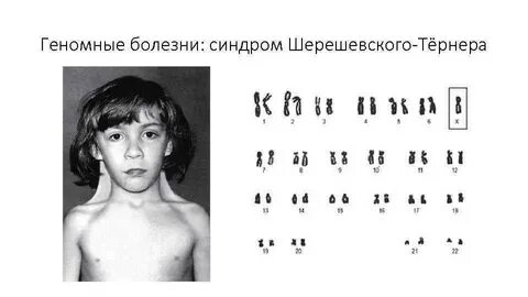 Май тернера