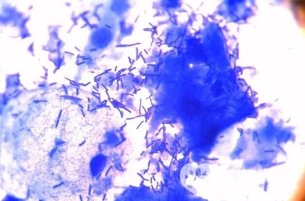 Лактобактерии палочки дедерлейна. Лактобациллы дедерлейна. Лактобактерии палочки дедерлейна. Палочки дедерлейна микроскопия. Палочки дедерлейна микроскопия.