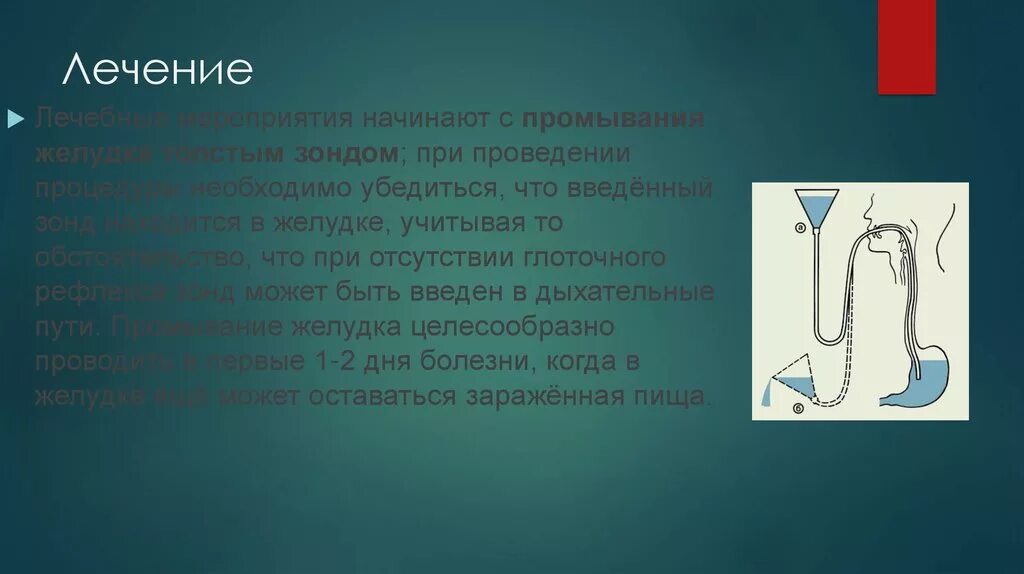 Промывание через зонд. Желудочный зонд для промывания желудка. При промывании желудка зонд вводится на глубину. Желудочный зонт при промывании желудка вводится.