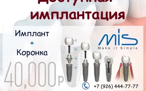 Имплант Ру Москва Интернет Магазин.