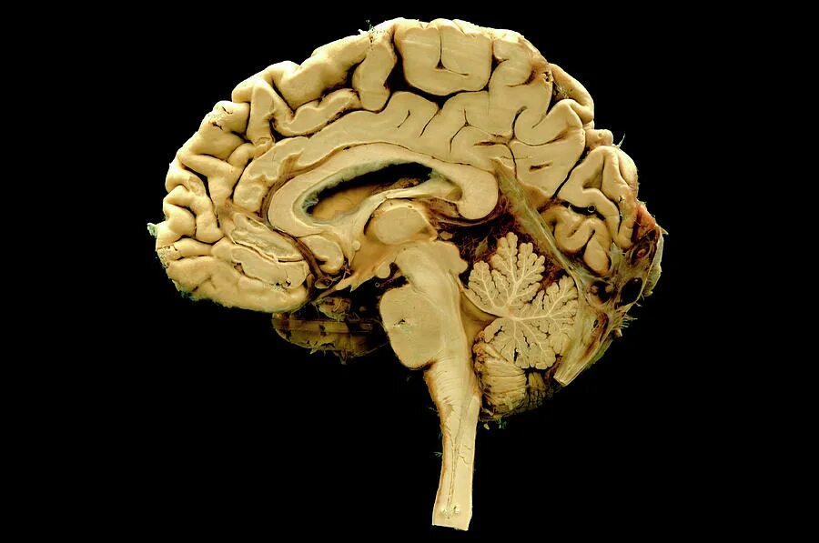 Головного мозга на ранних. Человеческий мозг в ра. Головной мозг человека в разрезе.