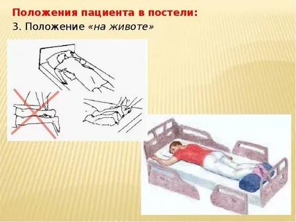 Положения тела пациента