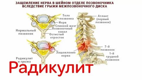 Лечение поясничного отдела в спб